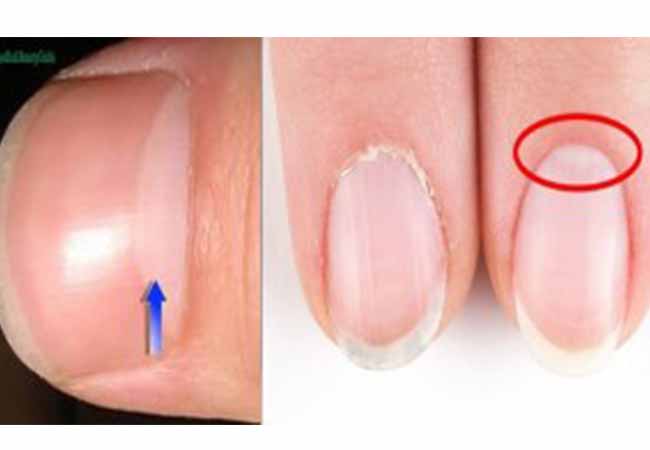 What Do Half Moons On Your Nails Mean Eagle Headline Have You Noticed The White Half Moons At Base Of Your Nails They Are Called Lunula And Can Sometimes Change In Color Size
